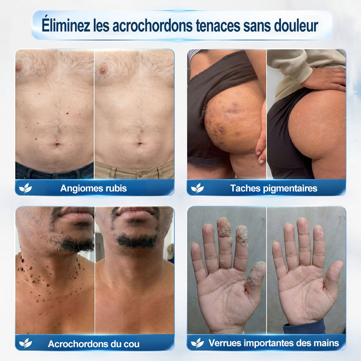 🎉 𝐏i𝐜𝐝o® – Félicitations ! Vous êtes notre grand gagnant 🎁 Vous bénéficiez de 50 % de réduction sur votre commande, soit la moitié du prix. Profitez de cette offre pour vous faire plaisir à moindre coût. Offre limitée dans le temps ✨