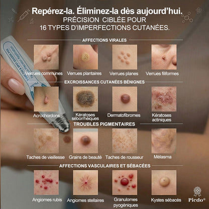 🎉 𝐏i𝐜𝐝o® – Félicitations ! Vous êtes notre grand gagnant 🎁 Vous bénéficiez de 50 % de réduction sur votre commande, soit la moitié du prix. Profitez de cette offre pour vous faire plaisir à moindre coût. Offre limitée dans le temps ✨